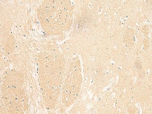 Immunohistochemistry of paraffin-embedded Human brain tissue using IL37 Polyclonal Antibody at dilution of 1:50(×200)