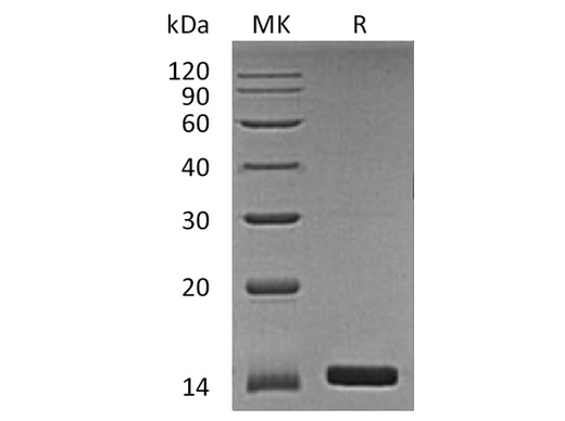 Recombinant Human Angiogenin/ANG Protein - ABMIUM