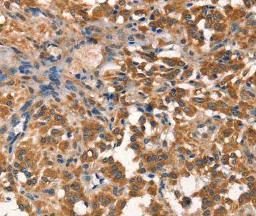 Anti-Human/Mouse AGO1 Antibody