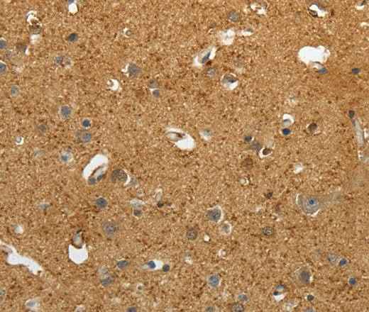 Anti-Human AKAP12 Antibody