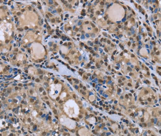 Anti-Human/Mouse/Rat DYNLL1 Antibody - ABMIUM