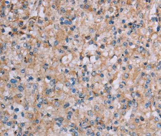Anti-Human/Mouse PLXNA4 Antibody