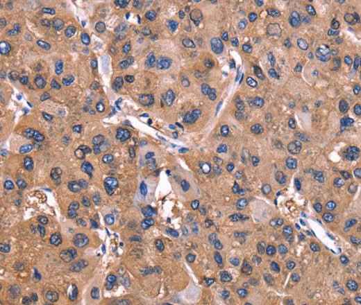 Anti-Human/Mouse/Rat ADM2 Antibody