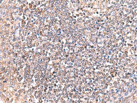 Immunohistochemistry of paraffin-embedded Human tonsil tissue using GRIA2 Polyclonal Antibody at dilution of 1:50(×200)