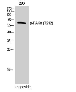 Western Blot analysis of 293T cells with Phospho-PAK1 (Thr212) Polyclonal Antibody