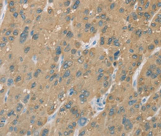 Anti-Human CYP2C9 Antibody - ABMIUM
