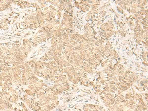 Anti-Human IL32 Antibody