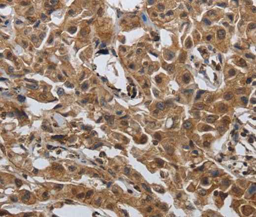 Anti-Human/Mouse PDCD7 Antibody - ABMIUM