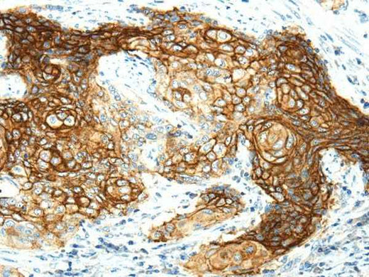 Anti-Human/Mouse/Rat AQP3 Antibody