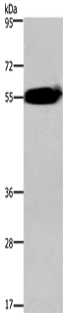 Anti-Human/Mouse/Rat ACVR2A Antibody - ABMIUM