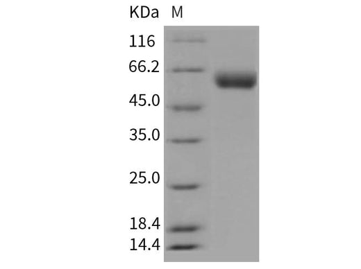 Recombinant Mouse VNN1/Vanin-1 Protein (His Tag) - ABMIUM