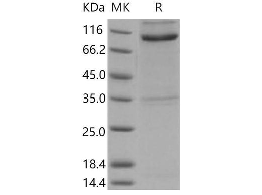 > 85 % as determined by reducing SDS-PAGE.