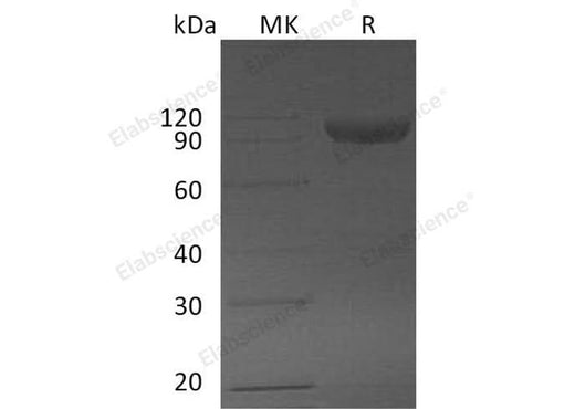Recombinant Mouse SerpinF2/SERPINF2 Protein (Fc Tag) - ABMIUM