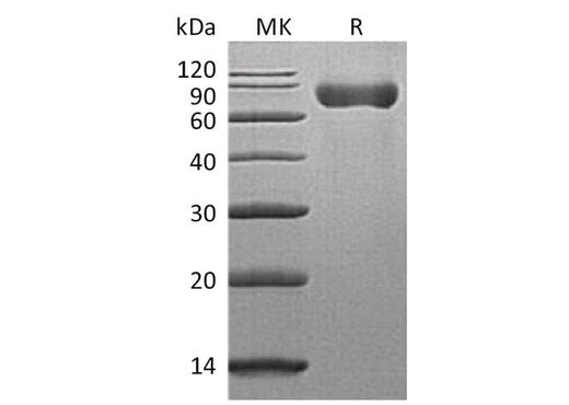 Recombinant Mouse SLAMF3/CD229 Protein (His Tag) - ABMIUM