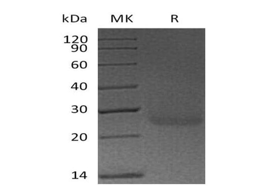 Recombinant Human Podoplanin/PDPN Protein (His Tag) - ABMIUM