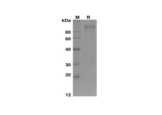 SDS-PAGE analysis of Human SELP proteins, 2 μg/lane of Recombinant Human SELP proteins was resolved with SDS-PAGE under reducing conditions, showing bands at 110-130 kDa.