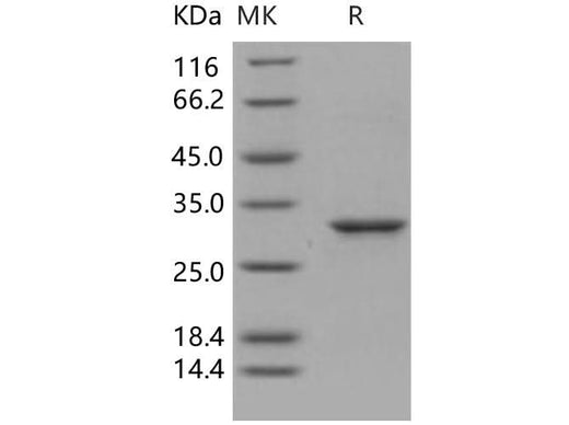 Recombinant Human 14-3-3 epsilon/YWHAE Protein - ABMIUM