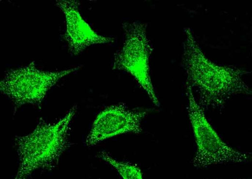 Anti-Rat PAK1 Antibody - ABMIUM