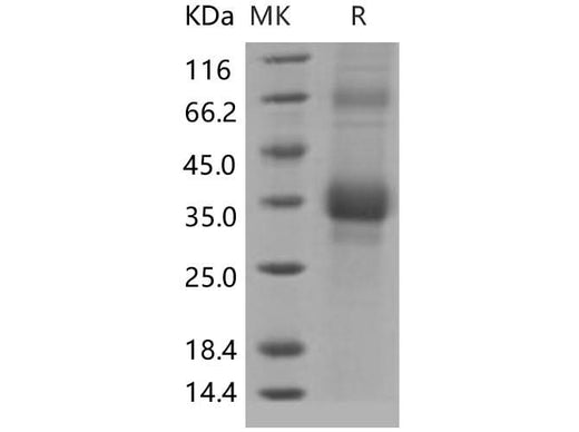 > 76 % as determined by reducing SDS-PAGE.