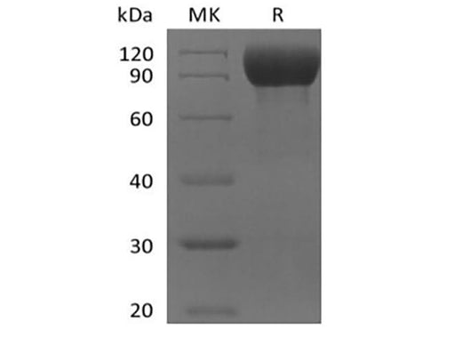 Recombinant Mouse IL-1 Receptor-Like 2/IL-1RL2/IL-1Rrp2/IL-36R (C-Fc) - ABMIUM