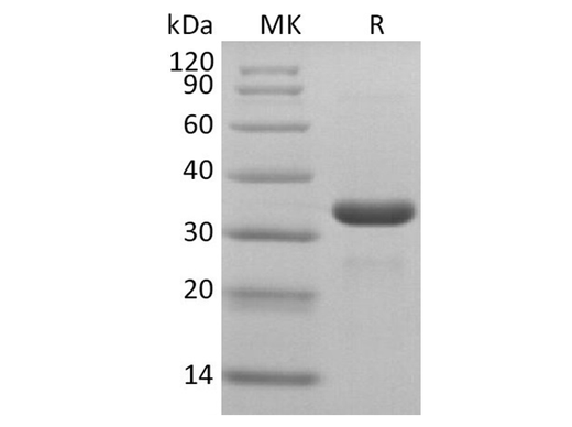 Recombinant SARS-CoV-2 3C-like Proteinase Protein (His Tag) - ABMIUM
