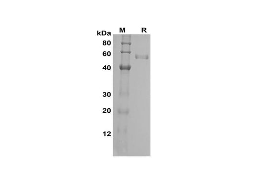 SDS-PAGE analysis of Human FGF23 proteins, 2 μg/lane of Recombinant Human FGF23 proteins was resolved with SDS-PAGE under reducing conditions, showing bands at 55 kDa.