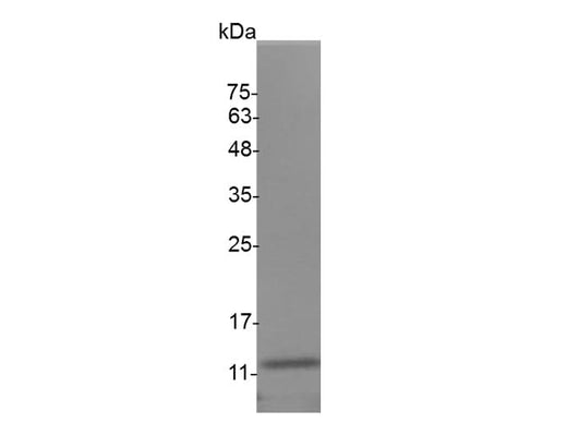 Recombinant Mouse IL-5 protein(His Tag) - ABMIUM