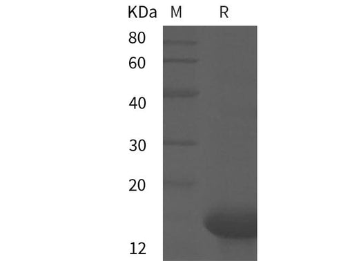 SDS-PAGE analysis of Mouse IL21 proteins, 2 μg/lane of Recombinant Mouse IL21 proteins was resolved with SDS-PAGE under reducing conditions, showing bands at 15 kDa.