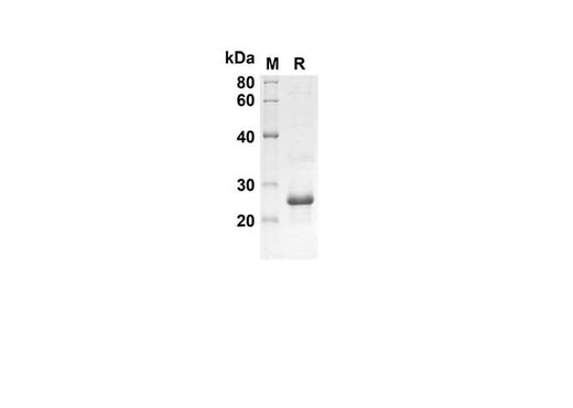 SDS-PAGE analysis of Mouse IL7 proteins, 2 μg/lane of Recombinant Mouse IL7 proteins was resolved with SDS-PAGE under reducing conditions, showing bands at 27 kDa.