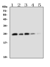 Anti-TNF alpha Antibody Picoband® Boster Bio