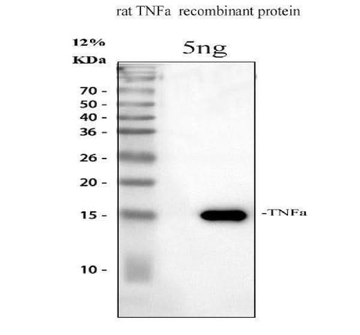 Anti-TNF alpha Antibody Picoband® Boster Bio
