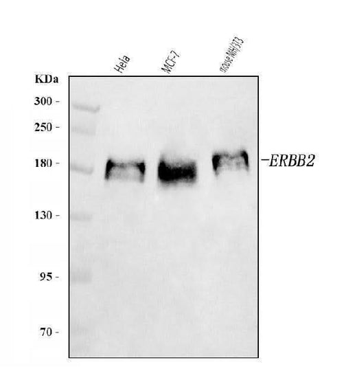 Anti-HER2/ERBB2 Antibody Picoband® Boster Bio
