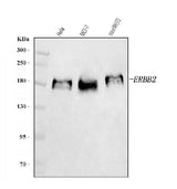 Anti-HER2/ERBB2 Antibody Picoband® Boster Bio