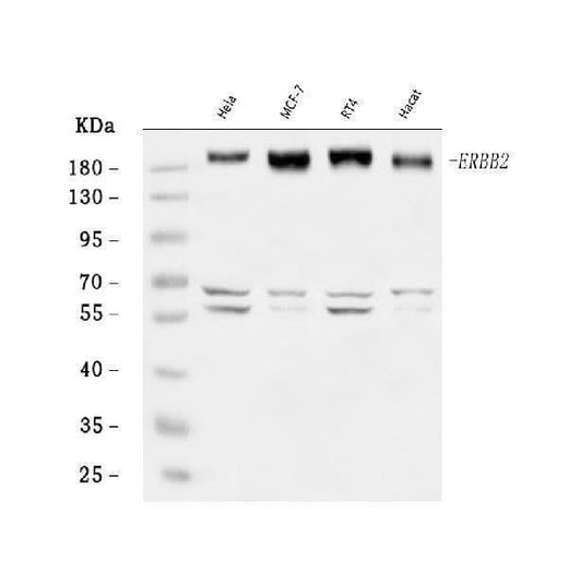 Anti-HER2/ERBB2 Antibody Picoband® Boster Bio