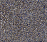 Anti-TGF beta 1/TGFB1 Antibody Boster Bio