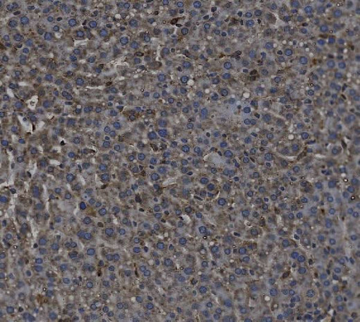 Anti-TGF beta 1/TGFB1 Antibody Boster Bio