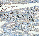 Anti-CTLA4 Antibody Boster Bio