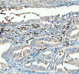 Anti-CTLA4 Antibody Boster Bio