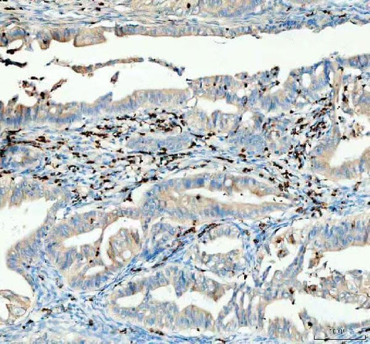 Anti-CTLA4 Antibody Boster Bio