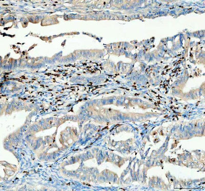 Anti-CTLA4 Antibody Boster Bio