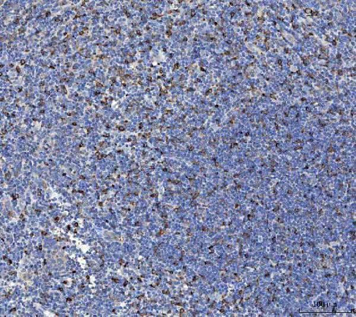 Anti-IL-10/IL10 Antibody Boster Bio