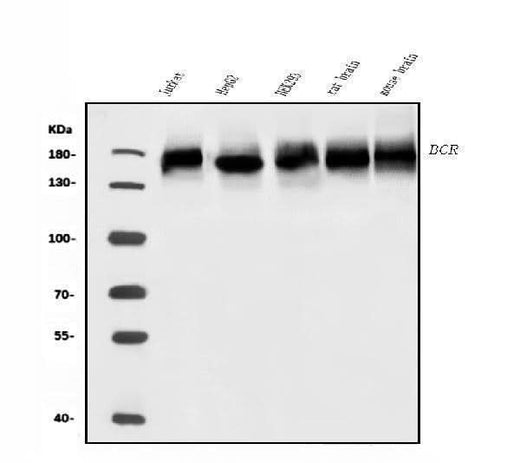 Anti-BCR Antibody Picoband® Boster Bio