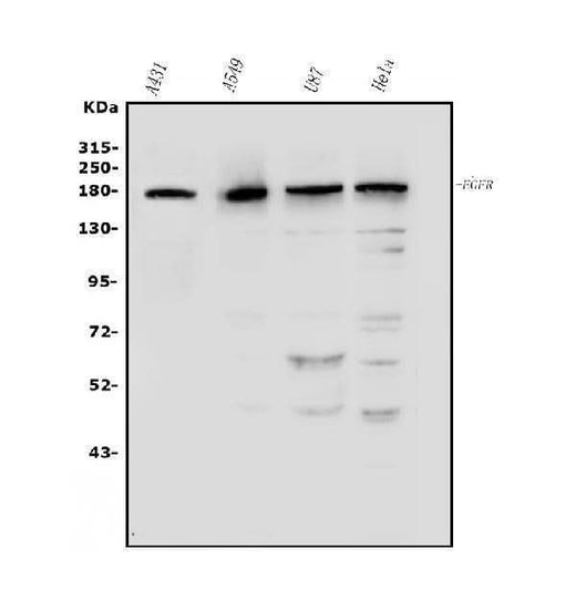 Anti-EGFR Antibody Picoband® Boster Bio