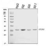 Anti-MYD88 Antibody Picoband® Boster Bio