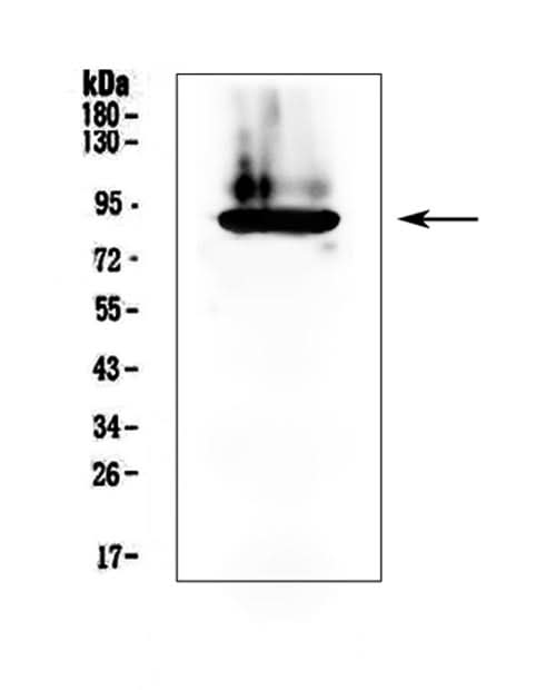 Anti-Prothrombin/F2 Antibody Picoband® Boster Bio