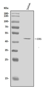 Anti-CCR5 Antibody Picoband® Boster Bio