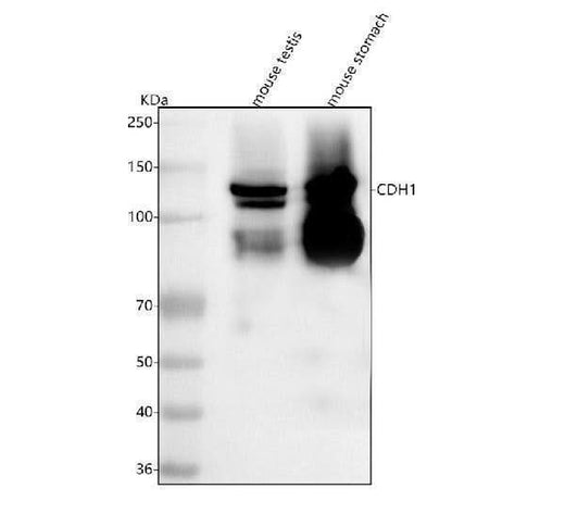 Anti-E-cadherin/Cdh1 Antibody Picoband® Boster Bio