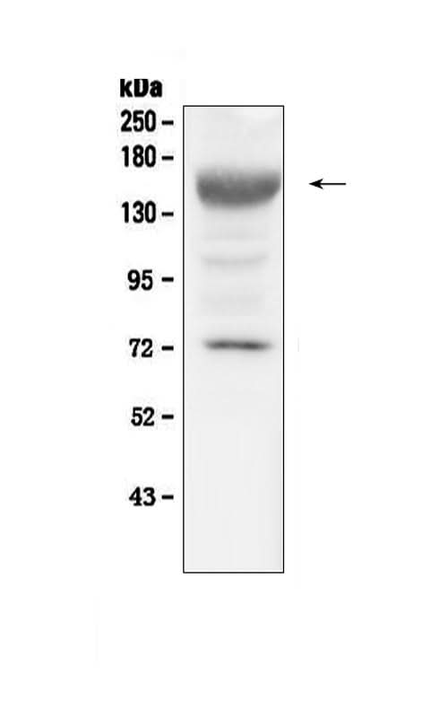 Anti-IGF1 Receptor/Igf1r Antibody Picoband® Boster Bio