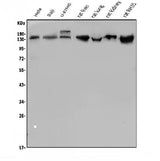 Anti-LDL Receptor/LDLR Antibody Picoband® Boster Bio