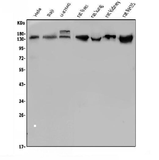 Anti-LDL Receptor/LDLR Antibody Picoband® Boster Bio